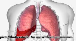 Hämatothorax